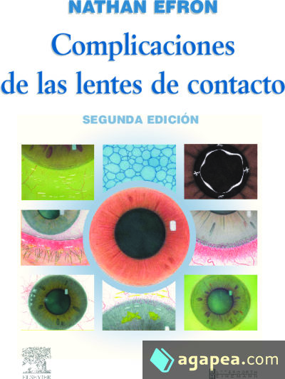 Complicaciones de las lentes de contacto