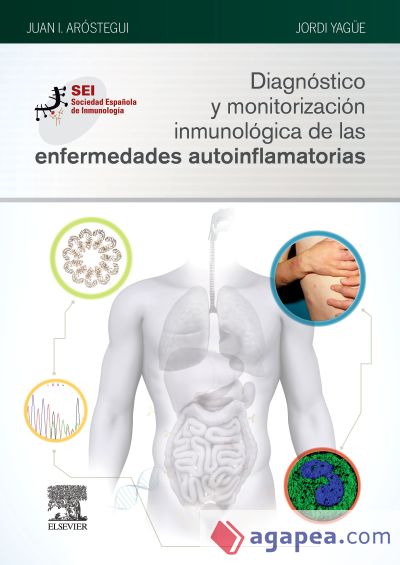 Diagnóstico y monitorización inmunológica de las enfermedades autoinflamatorias