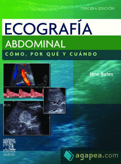 Ecografía abdominal