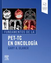 Portada de FUNDAMENTOS DE LA PET-TC EN ONCOLOGÍA