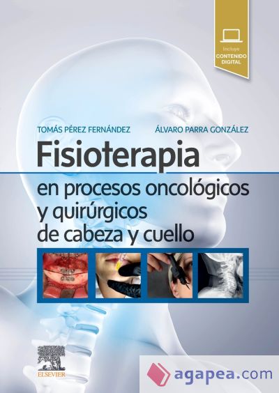 Fisioterapia en procesos oncológicos y quirúrgicos de cabeza y cuello