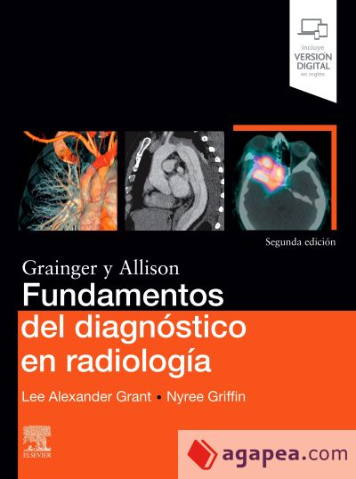 Fundamentos del diagnóstico en radiología