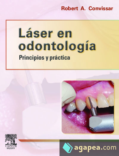 Láser en odontología