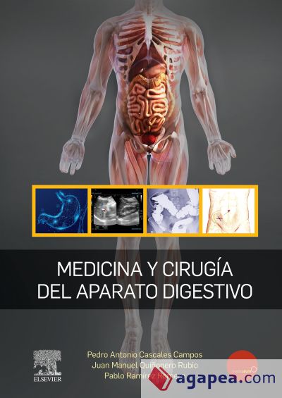 MEDICINA Y CIRUGÍA DEL APARATO DIGESTIVO