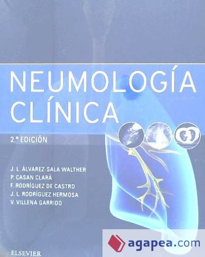 Neumología clínica - 2ª edición