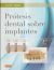 Portada de Prótesis dental sobre implantes, de Carl E. Misch