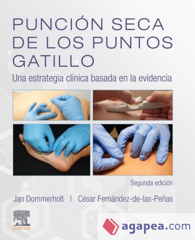 Punción seca de los puntos gatillo (2ª ed.)