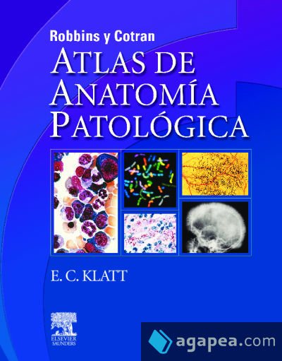 ROBBINS y COTRAN. Atlas de anatomía patológica