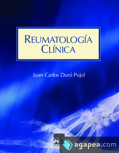 Reumatología clínica