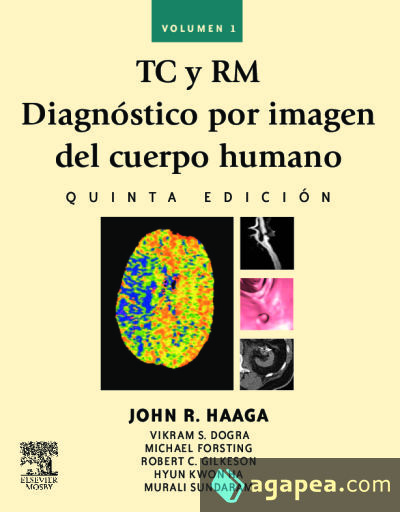 TC y RM. Diagnóstico por imagen del cuerpo humano