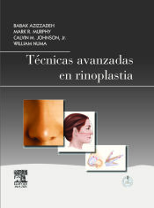 Portada de Técnicas avanzadas en rinoplastia + StudentConsult en español