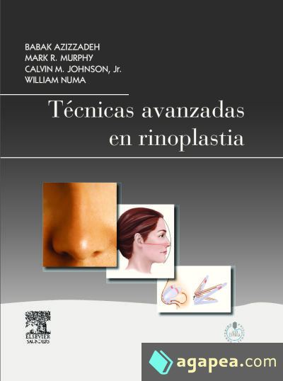 Técnicas avanzadas en rinoplastia + StudentConsult en español