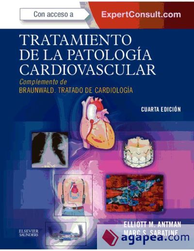 Tratamiento de la patología cardiovascular