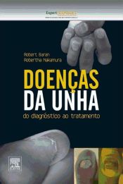 Portada de Doenças Da Unha (Ebook)