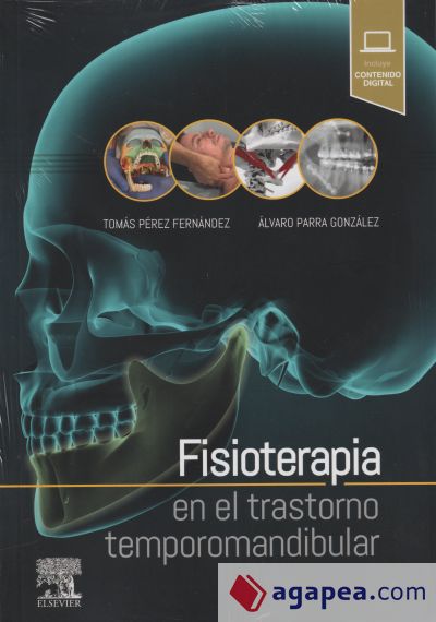 Fisioterapia en el trastorno temporomandibular