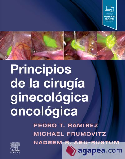 Principios de la cirugía ginecológica oncológica