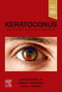 Portada de Keratoconus:diagnosis and management