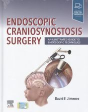 Portada de Endoscopic Craniosynostosis Surgery