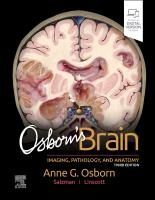 Portada de Osborn's Brain