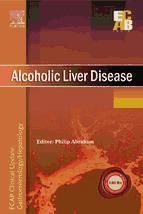 Portada de Alcoholic Liver Disease - ECAB (Ebook)