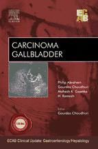 Portada de Carcinoma Gallbladder - ECAB (Ebook)