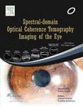 Portada de Spectral-domain Optical Coherence Tomography Imaging of the Eye (Ebook)