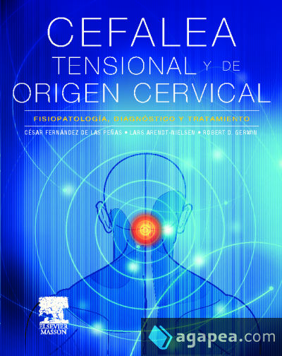 Cefalea tensional de origen cervical