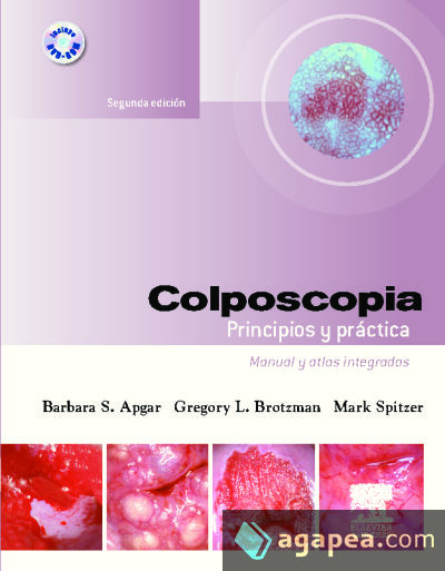 Colposcopia. Principios y práctica + DVD-ROM