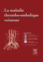 Portada de La maladie thrombo-embolique veineuse (Ebook)