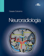 Portada de Neuroradiologia (Ebook)