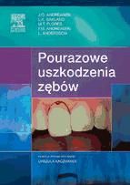 Portada de Pourazowe uszkodzenia z?bów, wyd. II (Ebook)