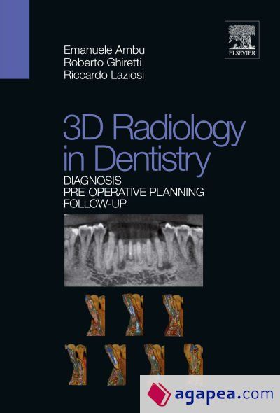 3D Radiology in Dentistry. Diagnosis Pre-operative Planning Follow-up
