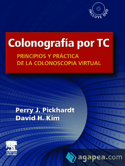 Colonografía por TC: Principios y práctica de la colonoscopia virtual + DVD