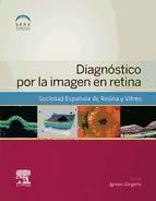 Portada de Diagnóstico por la imagen en retina (Ebook)