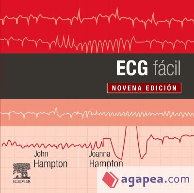 ECG fácil