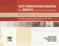 Portada de Electroencefalografía del adulto (Ebook)