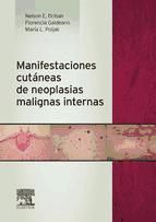 Portada de Manifestaciones cutáneas de neoplasias malignas internas (Ebook)