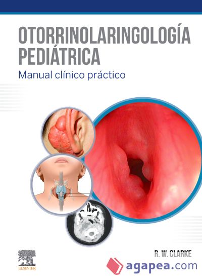 Otorrinolaringología pediátrica