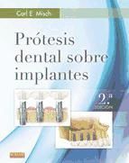 Portada de Prótesis dental sobre implantes (Ebook)