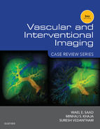 Portada de Vascular and Interventional Imaging: Case Review Series E-Book (Ebook)