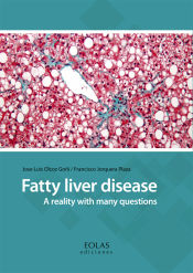 Portada de Fatty liver disease