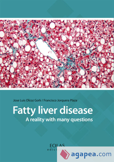 Fatty liver disease