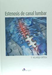 Portada de Estenosis del canal lumbar