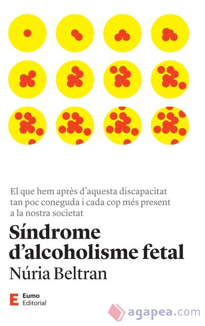 Síndrome d'alcoholisme fetal