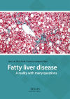 Fatty liver disease