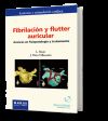 Fibrilación y flutter auricular