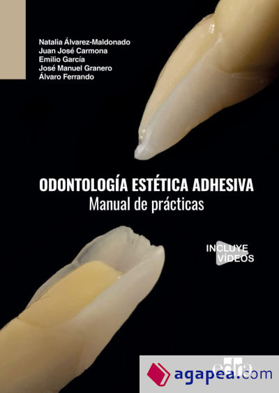 Odontología estética adhesiva. Manual de prácticas