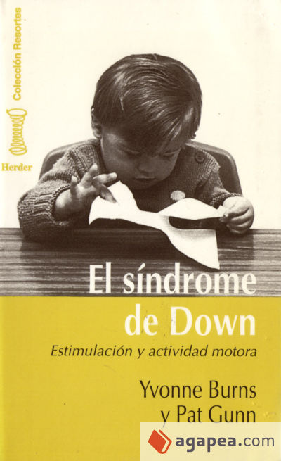 El síndrome de Down