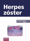 Herpes zóster