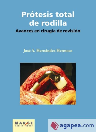 Avances en cirugía de revisión de la prótesis total de rodilla